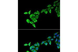 Immunofluorescence analysis of HeLa cells using MECOM Polyclonal Antibody (MECOM 抗体)