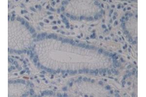 Detection of HIF1aN in Human Stomach Tissue using Polyclonal Antibody to Hypoxia Inducible Factor 1 Alpha Subunit Inhibitor (HIF1aN)