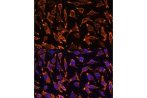 Immunofluorescence analysis of L929 cells using TNFRSF11A Polyclonal Antibody (ABIN6127589, ABIN6149310, ABIN6149312 and ABIN6217357) at dilution of 1:100 (40x lens). (TNFRSF11A 抗体  (AA 466-616))