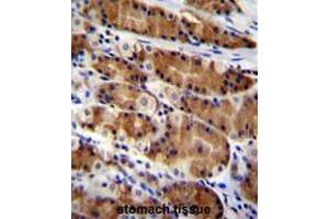 CCDC84 Antibody (N-term) immunohistochemistry analysis in formalin fixed and paraffin embedded human stomach tissue followed by peroxidase conjugation of the secondary antibody and DAB staining. (CCDC84 抗体  (N-Term))