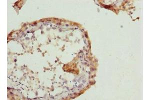Immunohistochemistry of paraffin-embedded human testis tissue using ABIN7167361 at dilution of 1:100 (RAB5B 抗体  (AA 1-215))