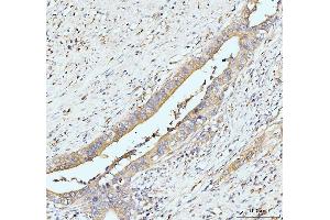IHC analysis of GIT1 using anti-GIT1 antibody (ABIN7601683). (GIT1 抗体  (AA 415-736))