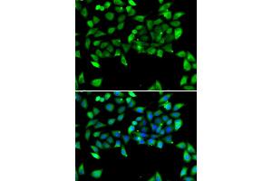 Immunofluorescence analysis of U20S cell using EIF3H antibody. (EIF3H 抗体)