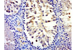 Paraformaldehyde-fixed, paraffin embedded rat testis tissue, Antigen retrieval by boiling in sodium citrate buffer(pH6) for 15min, Block endogenous peroxidase by 3% hydrogen peroxide for 30 minutes, Blocking buffer (normal goat serum) at 37°C for 20min, Antibody incubation with Rabbit Anti-MYCBPAP Polyclonal Antibody, Unconjugated  at 1:500 overnight at 4°C, followed by a conjugated secondary and DAB staining (MYCBPAP 抗体  (AA 401-500))