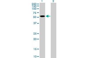 Western Blot analysis of ASL expression in transfected 293T cell line by ASL MaxPab polyclonal antibody. (ASL 抗体  (AA 1-464))