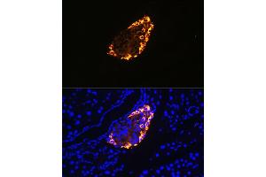 Immunofluorescence (IF) image for anti-Somatostatin (SST) (C-Term) antibody (ABIN6148498)
