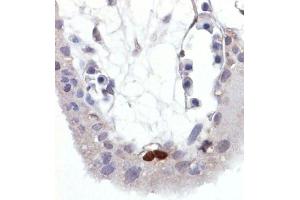 Immunohistochemistry staining of Wild-type p53 expressed in human trophoblast (paraffin-embedded sections). (p53 抗体  (pSer392))