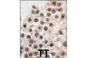 Formalin-fixed and paraffin-embedded human testis tissue reacted with ARID3B polyclonal antibody  , which was peroxidase-conjugated to the secondary antibody, followed by DAB staining. (ARID3B 抗体  (C-Term))