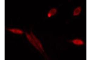 ABIN6275512 staining  HeLa cells by IF/ICC. (RUFY1 抗体  (Internal Region))