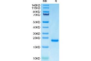Human PRL-1 on Tris-Bis PAGE under reduced condition. (PTP4A1 Protein (AA 1-170) (His tag))