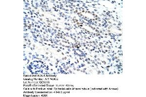 Rabbit Anti-NOL4 Antibody  Paraffin Embedded Tissue: Human Kidney Cellular Data: Epithelial cells of renal tubule Antibody Concentration: 4. (NOL4 抗体  (N-Term))