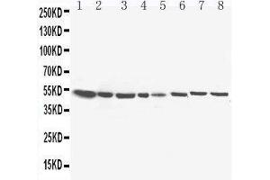 Lane 8: COLO320 Cell Lysate (HSD17B4 抗体  (C-Term))