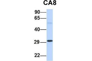 Host:  Rabbit  Target Name:  CA8  Sample Type:  Human Fetal Lung  Antibody Dilution:  1. (CA8 抗体  (Middle Region))