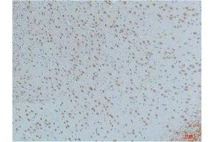 Immunohistochemistry (IHC) analysis of paraffin-embedded Mouse Brain Tissue using CaMKIIbeta/ gamma /delta (Phospho Thr287) Mouse Monoclonal Antibody diluted at 1:200. (CaMKIIbeta/gamma/delta 抗体  (pThr287))