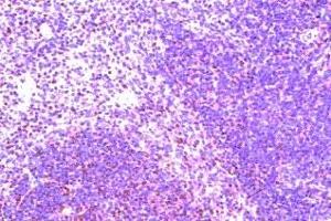 Immunohistochemistry on paraffin section of human spleen (CCR8 抗体  (AA 7-33))
