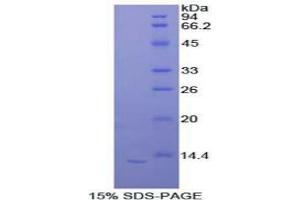 SDS-PAGE of Protein Standard from the Kit (Highly purified E. (IL-33 CLIA Kit)