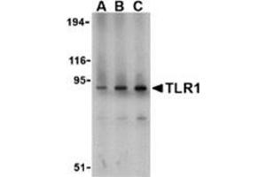 Western blot analysis of TLR1 in mouse spleen lysate with this product at (A) 1, (B) 2, and (C) 4 μg/ml. (TLR1 抗体  (N-Term))