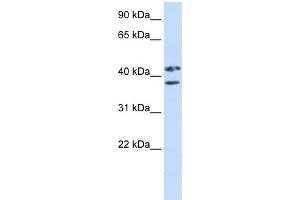 WB Suggested Anti-ZRANB2 Antibody Titration:  0. (ZNF265 抗体  (Middle Region))