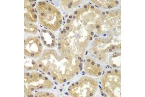 Immunohistochemistry of paraffin-embedded human kidney using CEBPG antibody (ABIN5974381) at dilution of 1/100 (40x lens). (CEBPG 抗体)