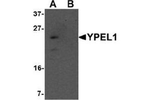 Western blot analysis of YPEL1 in Hela cell lysate with YPEL1 antibody at 1 ug/mL in (A) the absence and (B) the presence of blocking peptide. (YPEL1 抗体  (N-Term))