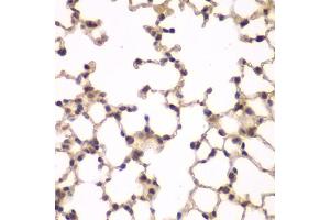 Immunohistochemistry (IHC) image for anti-Phosphatidylinositol-5-Phosphate 4-Kinase, Type II, alpha (PIP4K2A) (AA 120-350) antibody (ABIN6145673)
