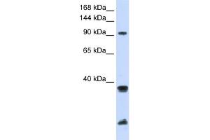 WB Suggested Anti-RNF20 Antibody Titration:  0. (RNF20 抗体  (Middle Region))
