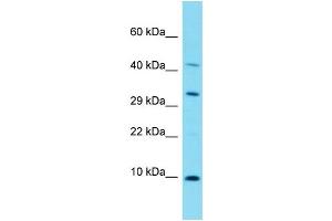 Host: Rabbit Target Name: C17orf89 Sample Type: Fetal Lung lysates Antibody Dilution: 1. (C17ORF89 抗体  (N-Term))