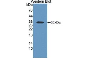 Western blot analysis of the recombinant protein. (PVRL4 抗体  (AA 31-317))