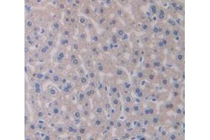 IHC-P analysis of Mouse Tissue, with DAB staining. (GBA 抗体  (AA 255-509))