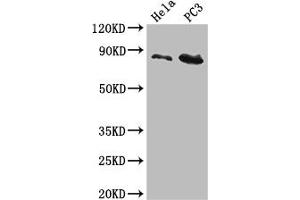 Western Blot Positive WB detected in: Hela whole cell lysate, PC-3 whole cell lysate All lanes: CUL2 antibody at 5 μg/mL Secondary Goat polyclonal to rabbit IgG at 1/50000 dilution Predicted band size: 87, 90 kDa Observed band size: 87 kDa (Cullin 2 抗体  (AA 591-742))