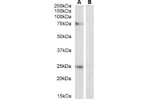 Western Blotting (WB) image for anti-delta-Like 1 (DLL1) (Internal Region) antibody (ABIN361190)