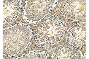 ABIN6260383 and ABIN6279247 at 1/100 staining rat testis tissue by IHC-P. (CA8 抗体  (C-Term))