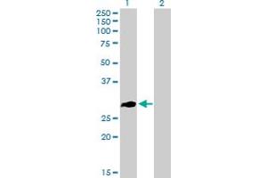 Western Blot analysis of ZNF32 expression in transfected 293T cell line by ZNF32 MaxPab polyclonal antibody.