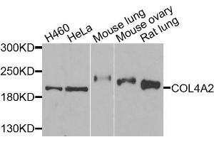 Western blot analysis of extracts of various cells, using COL4A2 antibody. (COL4a2 抗体)