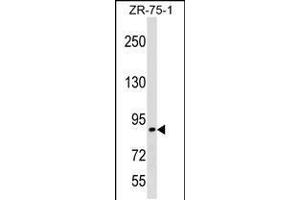 Western blot analysis in ZR-75-1 cell line lysates (35ug/lane). (RASA3 抗体  (C-Term))