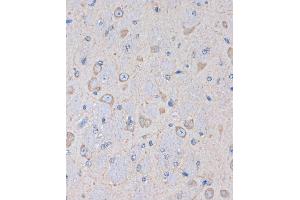 Immunohistochemistry of paraffin-embedded Mouse brain using OR2S2 Rabbit pAb (ABIN7269087) at dilution of 1:100 (40x lens). (OR2S2 抗体  (AA 200-300))