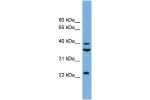 WB Suggested Anti-SAE1  Antibody Titration: 0. (SAE1 抗体  (N-Term))