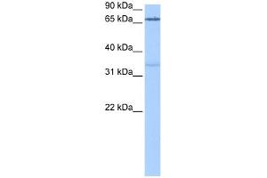 PADI2 antibody used at 0. (PADI2 抗体  (Middle Region))