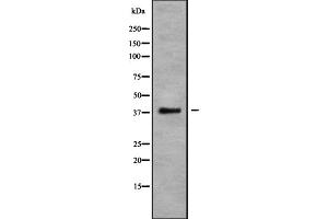 Western blot analysis of CCR10 using COLO205 whole cell lysates (CCR10 抗体  (C-Term))