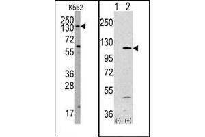 Image no. 1 for anti-Phosphoinositide-3-Kinase, Catalytic, alpha Polypeptide (PIK3CA) (Middle Region) antibody (ABIN360445) (PIK3CA 抗体  (Middle Region))