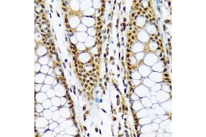 Immunohistochemistry of paraffin-embedded human colon using ML1BP Rabbit mAb (ABIN7268357) at dilution of 1:100 (40x lens). (MAD2L1BP 抗体)
