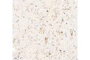 Immunohistochemistry of paraffin embedded mouse brain using P2Y12 (ABIN7075321) at dilution of 1: 1400 (400x lens) (P2RY12 抗体)