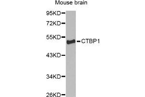 Western blot analysis of extracts of mouse brain, using CTBP1 Antibody (ABIN1872055) at 1:1000 dilution. (CTBP1 抗体)