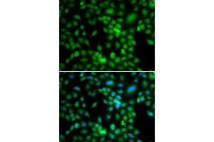 Immunofluorescence analysis of MCF-7 cells using SYCE1 antibody (ABIN5974347).