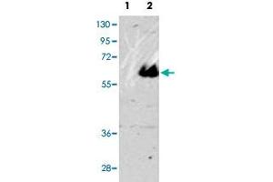 Western blot analysis of MAPT (arrow) using MAPT polyclonal antibody . (MAPT 抗体  (C-Term))
