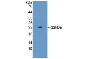 WB of Protein Standard: different control antibodies against Highly purified E. (FLT3LG CLIA Kit)
