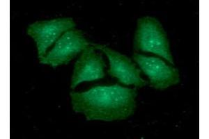 ICC/IF analysis of KCTD15 in HeLa cells. (KCTD15 抗体  (AA 1-159))