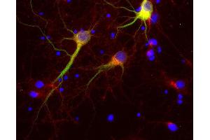 Indirect immunolabeling of PFA fixed rat hippocampus neurons with rabbit anti-Vti1a (dilution 1 : 500; red) and mouse anti-MAP 2 (cat. (VTI1A 抗体)