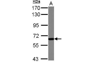Western Blotting (WB) image for anti-Glucokinase (Hexokinase 4) Regulator (GCKR) (AA 1-214) antibody (ABIN1501890) (GCKR 抗体  (AA 1-214))