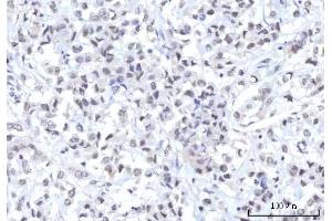 IHC analysis of RBM22 using anti-RBM22 antibody (ABIN7600268).
